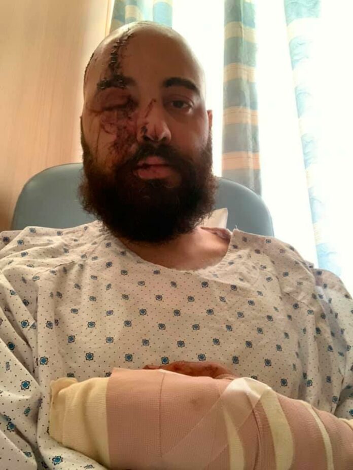 Bachir Ramadan, herido en la explosión de Beirut